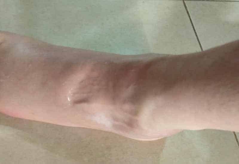 Impact zone on my foot - Lauda Air Crash Site Adventure Ride