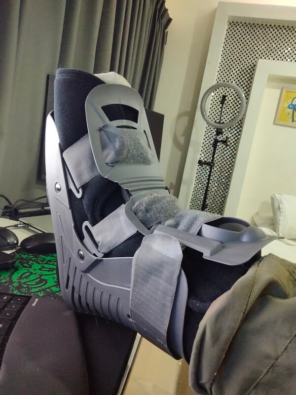 Understanding the Dangers of Riding and Driving in Thailand ankle-injury-thailand (59)