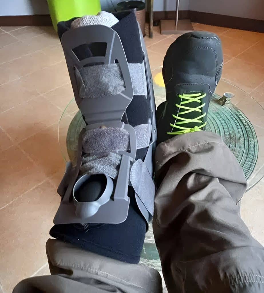 In January 2022, I injured my ankle while riding to the Lauda Air Flight 4 crash site in Phu Toei National Park, Thailand. I ended up in a cast and a foot brace for more than two months. I found myself in a situation where I needed to ride within a week of the injury, but there was no way it was possible.